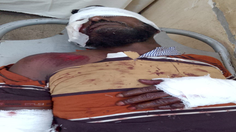 চৌগাছায় ট্রাকের ধাক্কায় সাইকেল আরোহী গুরুতর আহত