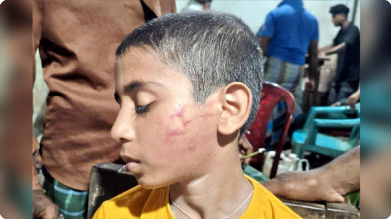 কেশবপুরে পরীক্ষার খাতায় কম নম্বরের কথা জানতে চাওয়ায় স্কুলছাত্রকে মারপিট