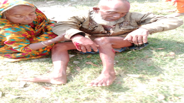 একদিনে কুকুরের কামড়ে ১৫ জন মনিরামপুর হাসপাতালে