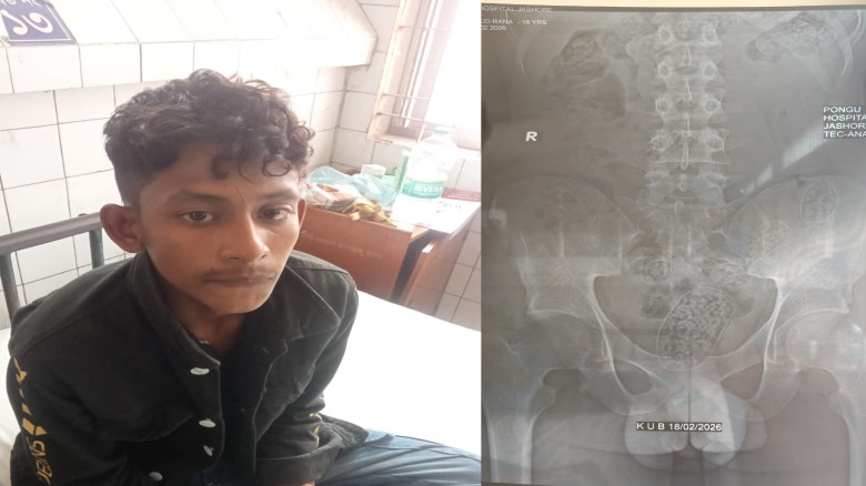 পেটভর্তি ইয়াবাসহ যুবক আটক