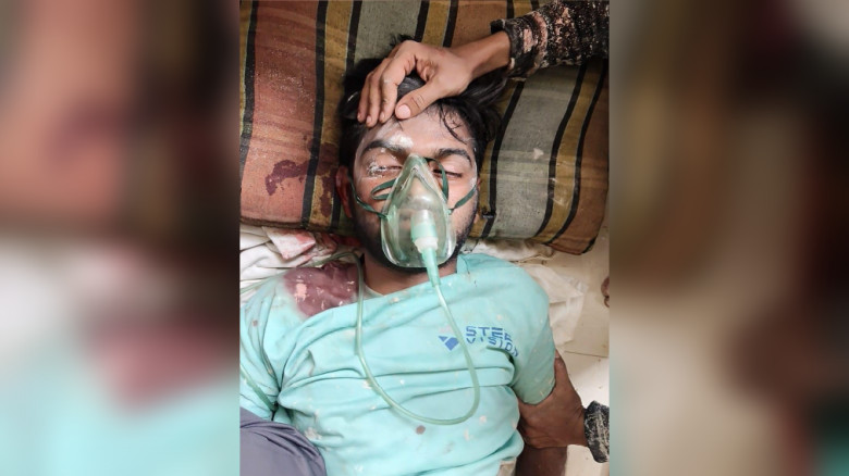 পাসপোর্ট অফিসের ভবনে কাজ করার সময় ছাদ থেকে পড়ে যুবক আহত