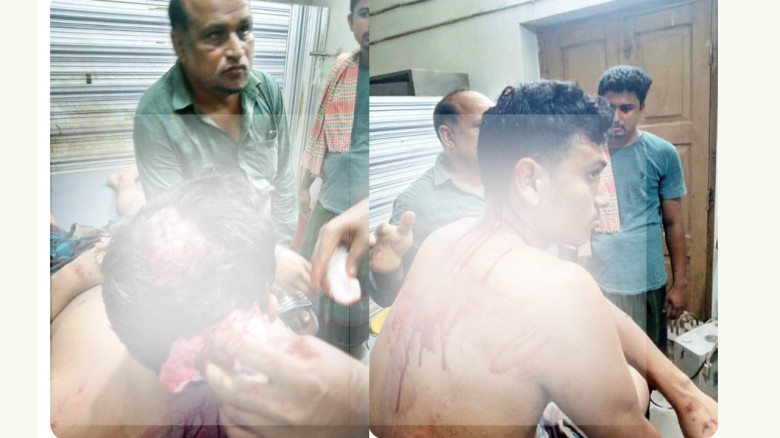নেইমারকে নিয়ে স্বস্তির খবর দিলো ব্রাজিল