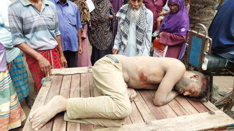 অভয়নগরে মোটরসাইকেল চোর সন্দেহে যুবককে গণপিটুনি, আশঙ্কাজনক অবস্থায় হাসপাতালে ভর্তি